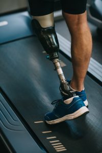 A man with a prosthetic limb walking on a treadmill